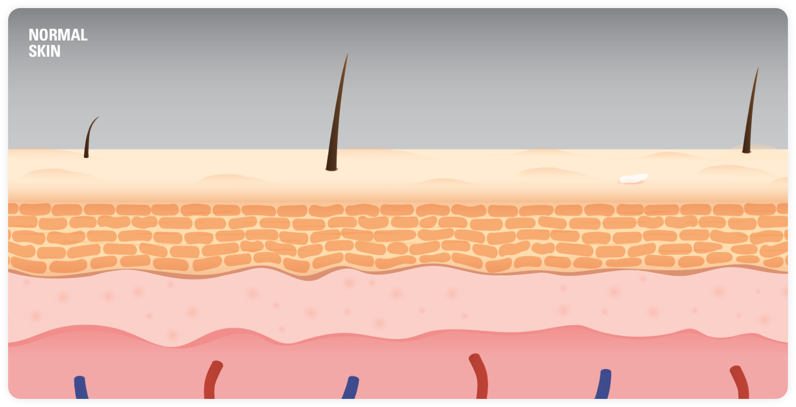 Normal skin