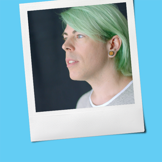 A polaroid of Tre, a person taking SKYRIZI treatment