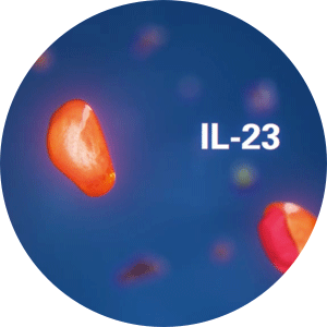 Il23 Protein Imbalance SKYRIZI