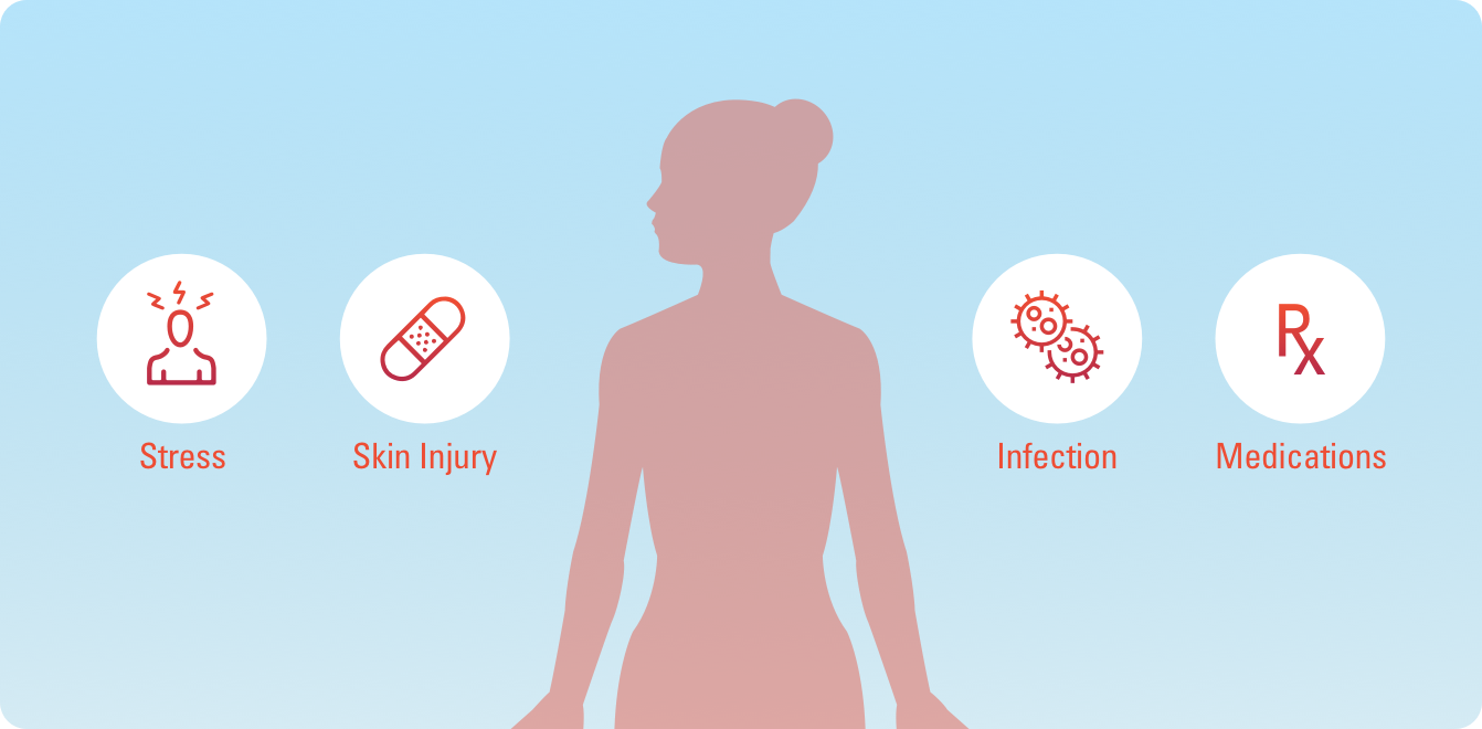 stress, skin injury, infection, medications